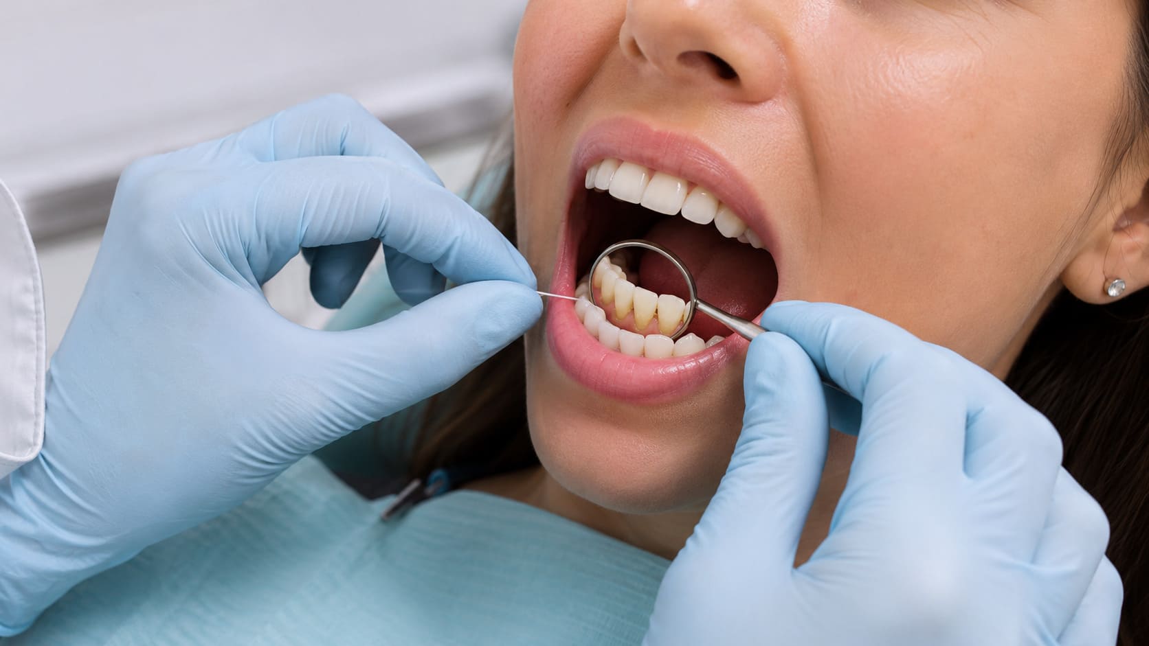 Риски развития кариеса